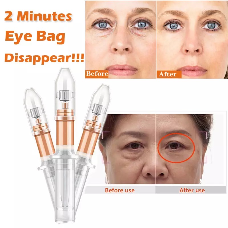 2 Mins Eye Bag Removal Cream 5PCS Long Lasting Effect Puffiness